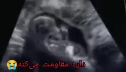 موشن گرافی سقط (2)